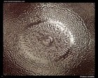 proteus mirabilis swarming